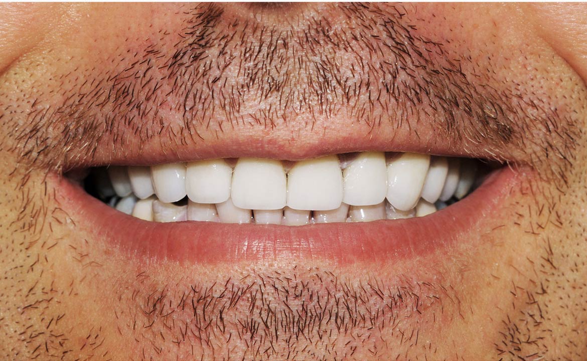 Before After Image