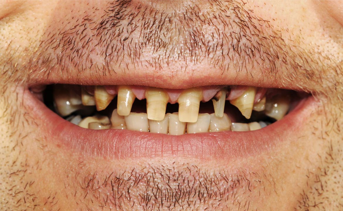 Before After Image